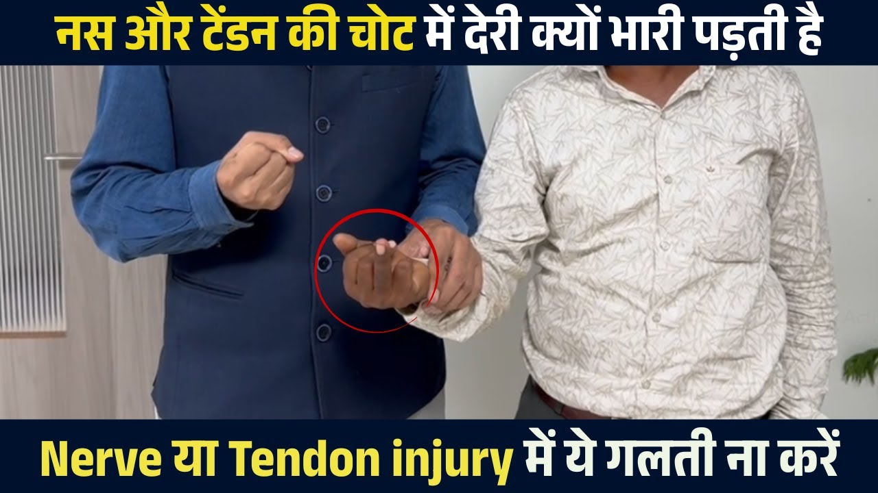 नस या टेंडन कटने के बाद 90% मरीज ये खतरनाक गलती कर बैठते हैं | Nerve or Tendon Injury Treatment