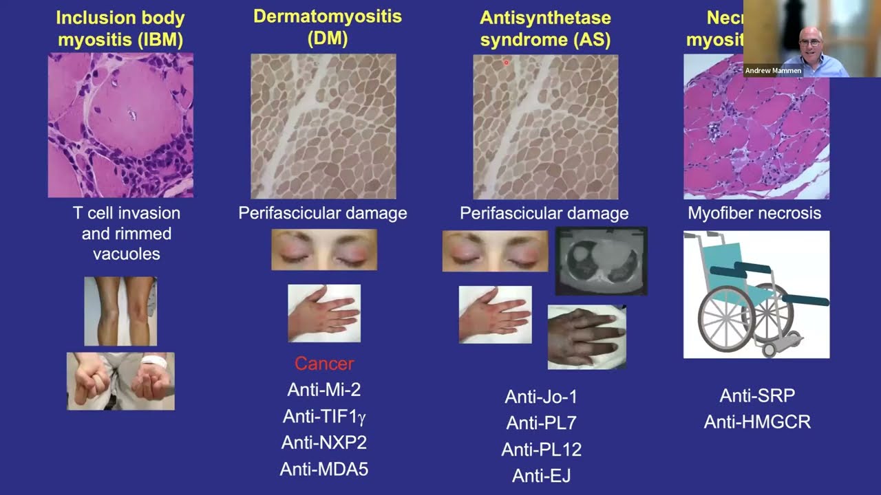 UW Rheumatology Grand Rounds - Andrew Mammen, 10/3/2023