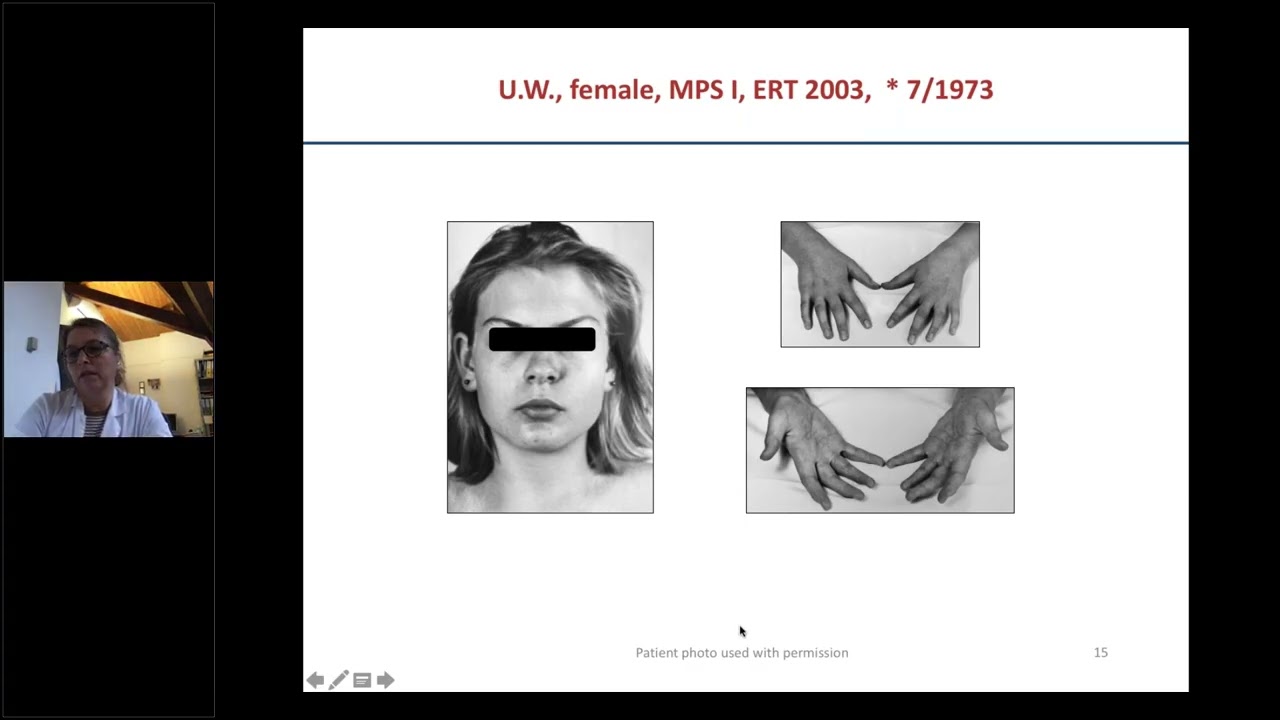 SES S3 M1 Joint and Bone Manifestations of Mucopolysaccharidoses   Case Studies