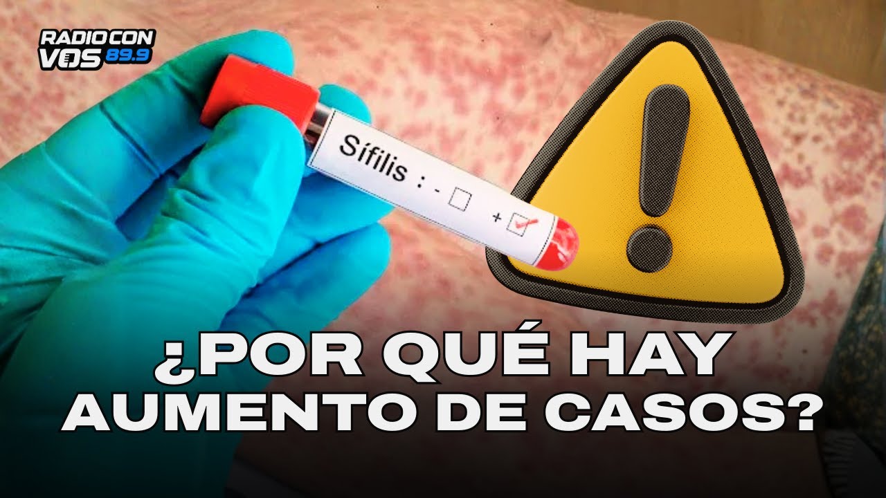 ALERTA SANITARIA: AUMENTARON los CASOS de SÍFILIS | LEANDRO CAHN en RADIO CON VOS