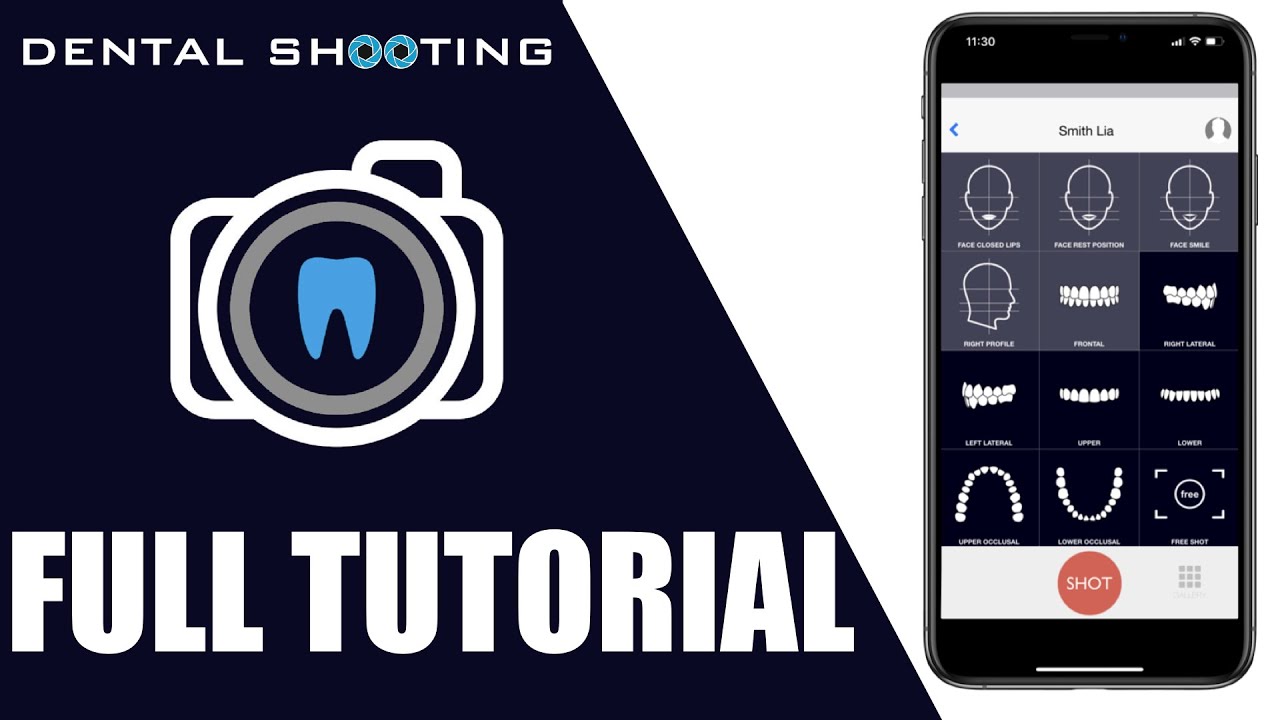 DENTAL SHOOTING APP: FULL TUTORIAL (Mobile Dental Photography)