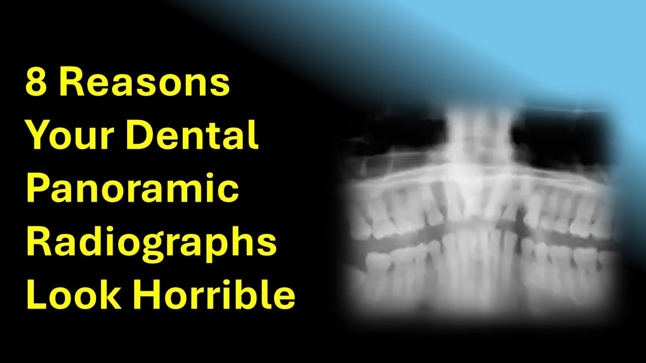 8 Reasons Your Dental Panoramic Radiographs Look Horrible