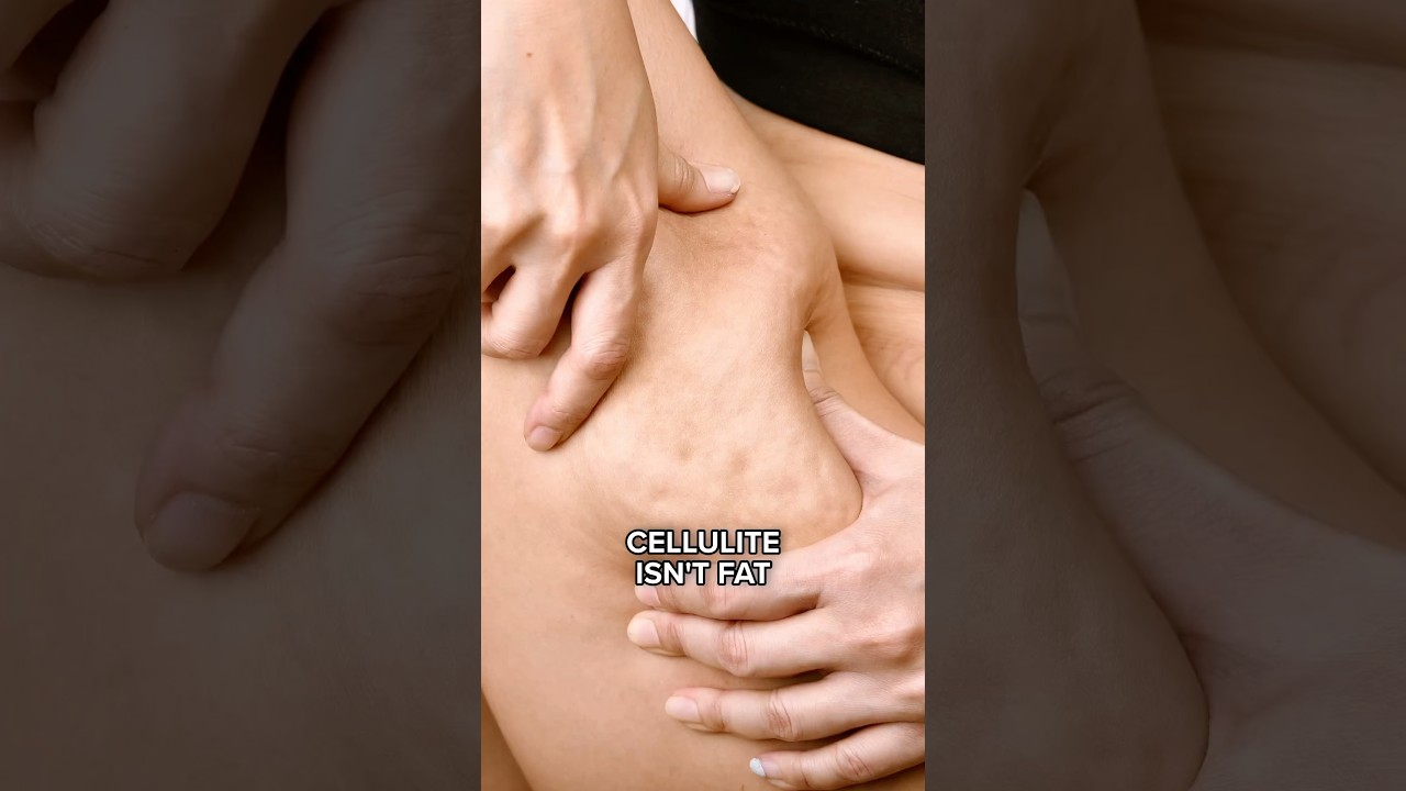 What Your Cellulite Is Really Telling You About Your Fascia