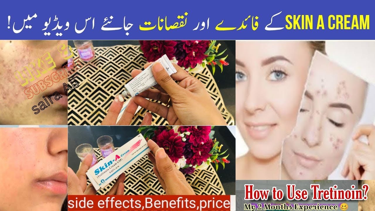 Skin A cream (Tretinoin ) how to use ? Skin A cream Uses and Side Effects