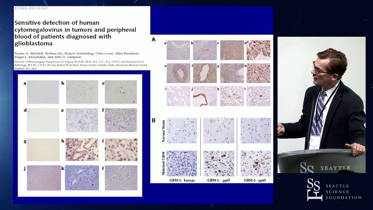 The Role of Cytomegalovirus in Tumorigenesis: Potential Treatment Target - Charles Cobbs, MD