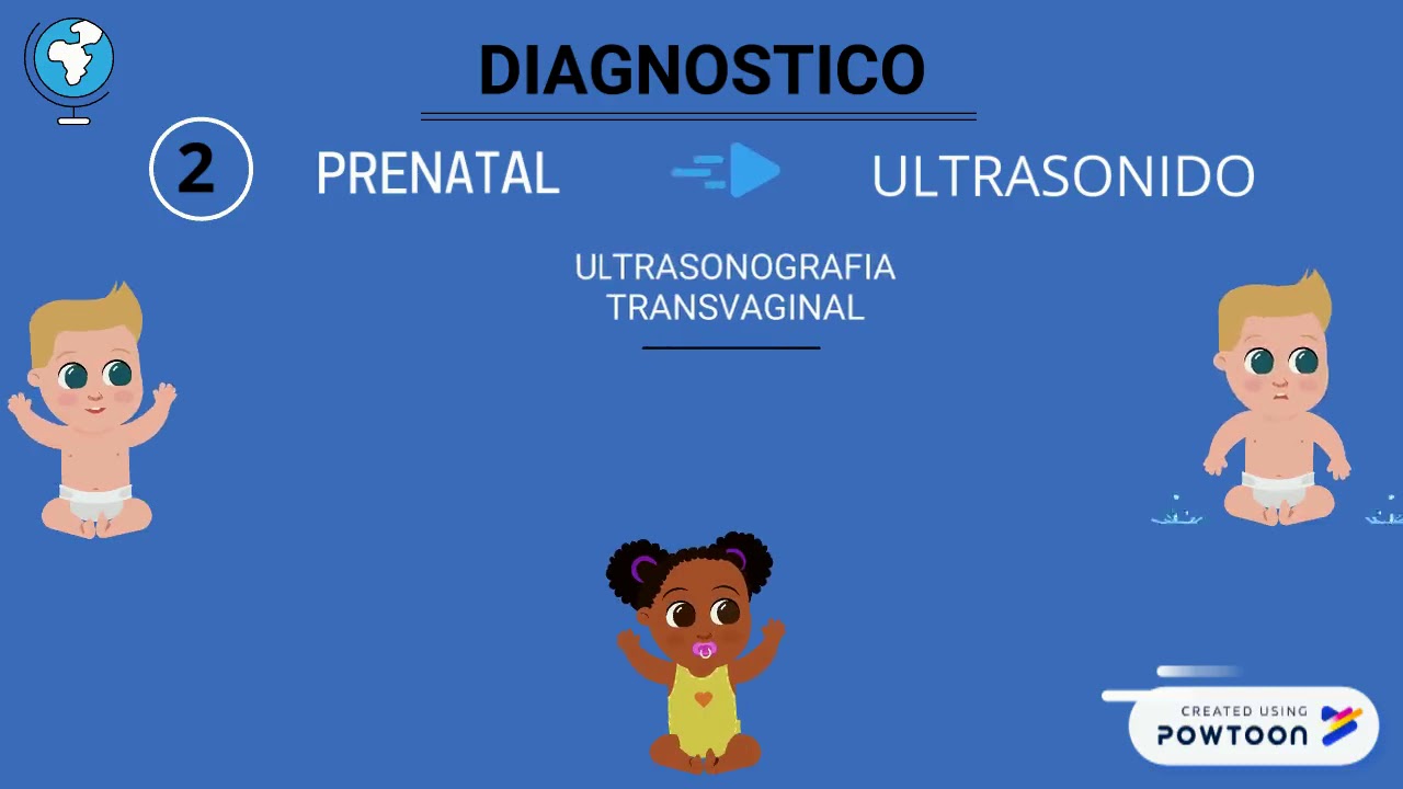 SINDROME DE DANDY WALKER