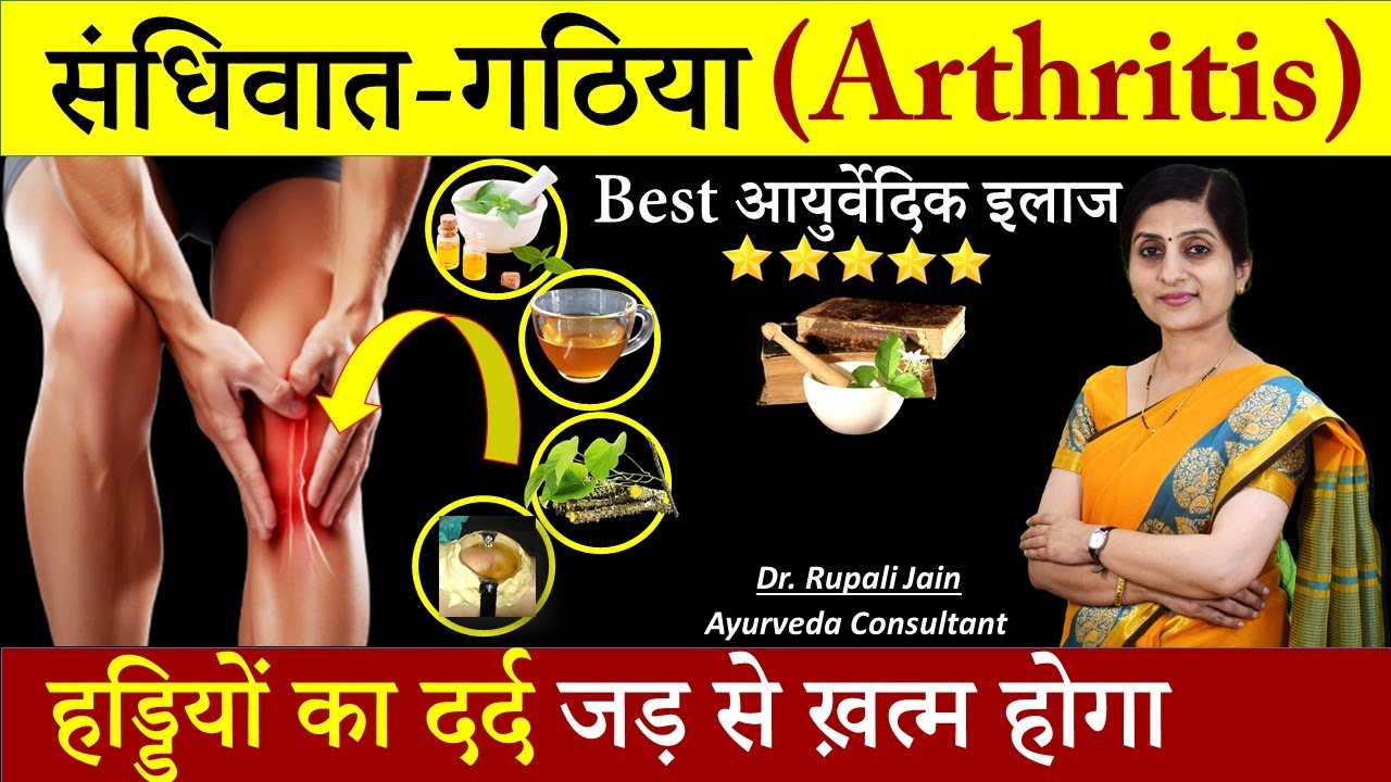 Best Ayurvedic Cure for Arthritis & Joint Pain- गठिया का आयुर्वेदिक इलाज ||संधिवात (OA) & आमवात (RA)
