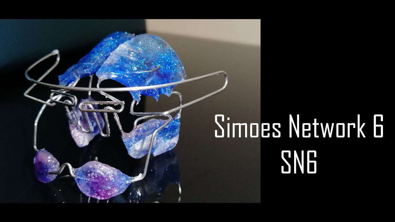 Elaboración de SN6 Simoes Network 6 | Elena Dental Art & More