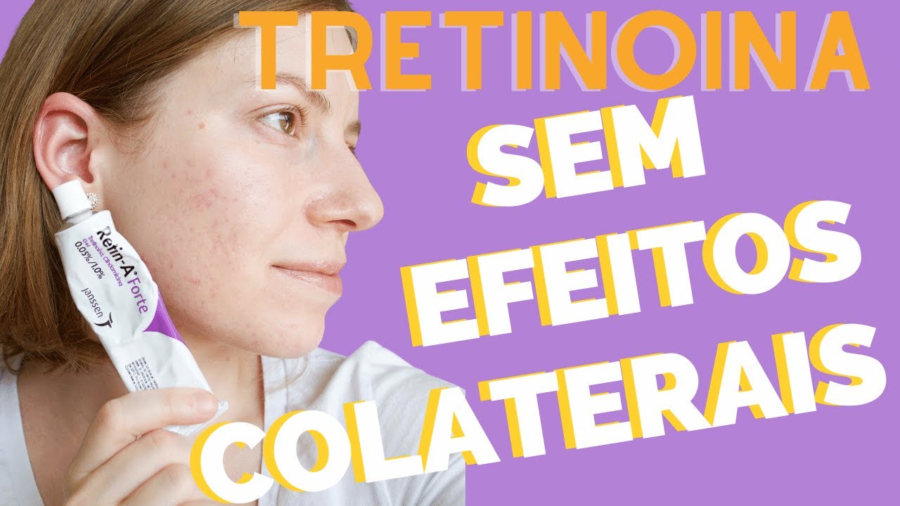 COMO COME&Ccedil;AR A USAR A TRETINOINA? | Vitanol A, Vitacid, Retin-A