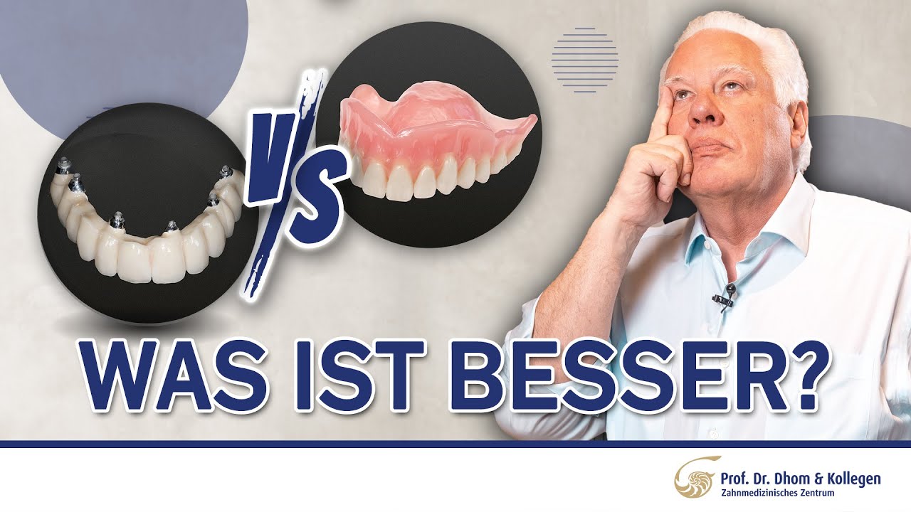 Fester oder herausnehmbarer Zahnersatz? Das musst du wissen!