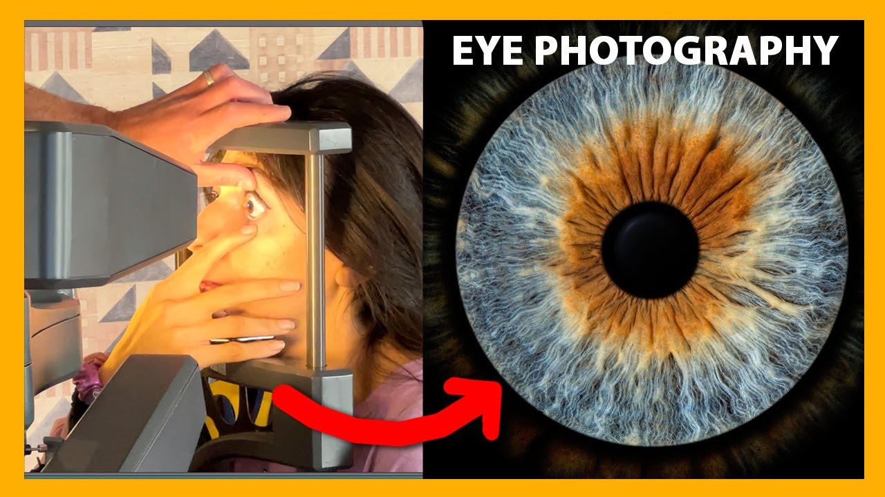 Taking a Picture of My Eye, Professionally! 