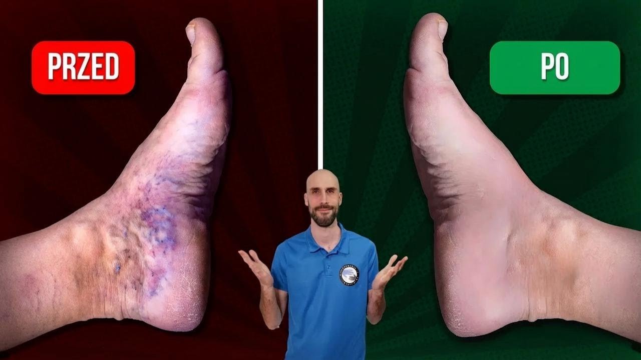 5 ćwiczeń na lepsze krążenie w nogach