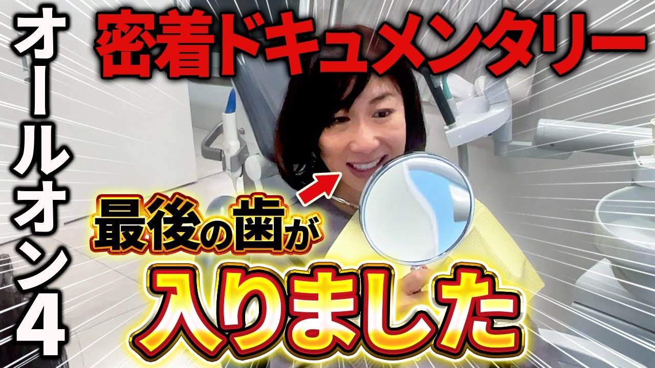 【密着ドキュメンタリー】手術から8か月。オールオン4の最後の歯が入る瞬間に密着！