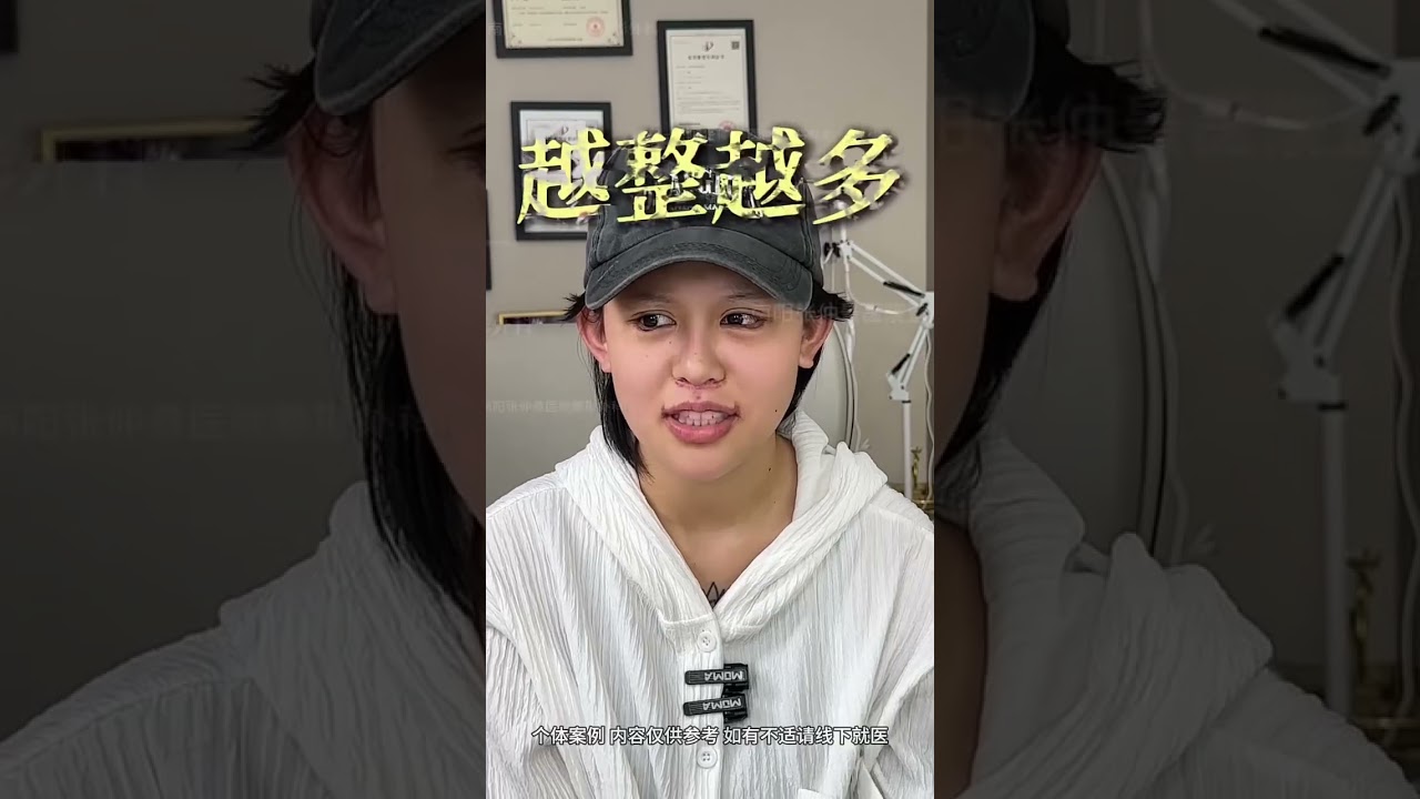 整容失败日记，她说，还会继续做 #fyp #plasticsurgery #trending #手术室日常 #rhinoplasty #faciallifting #面部提升