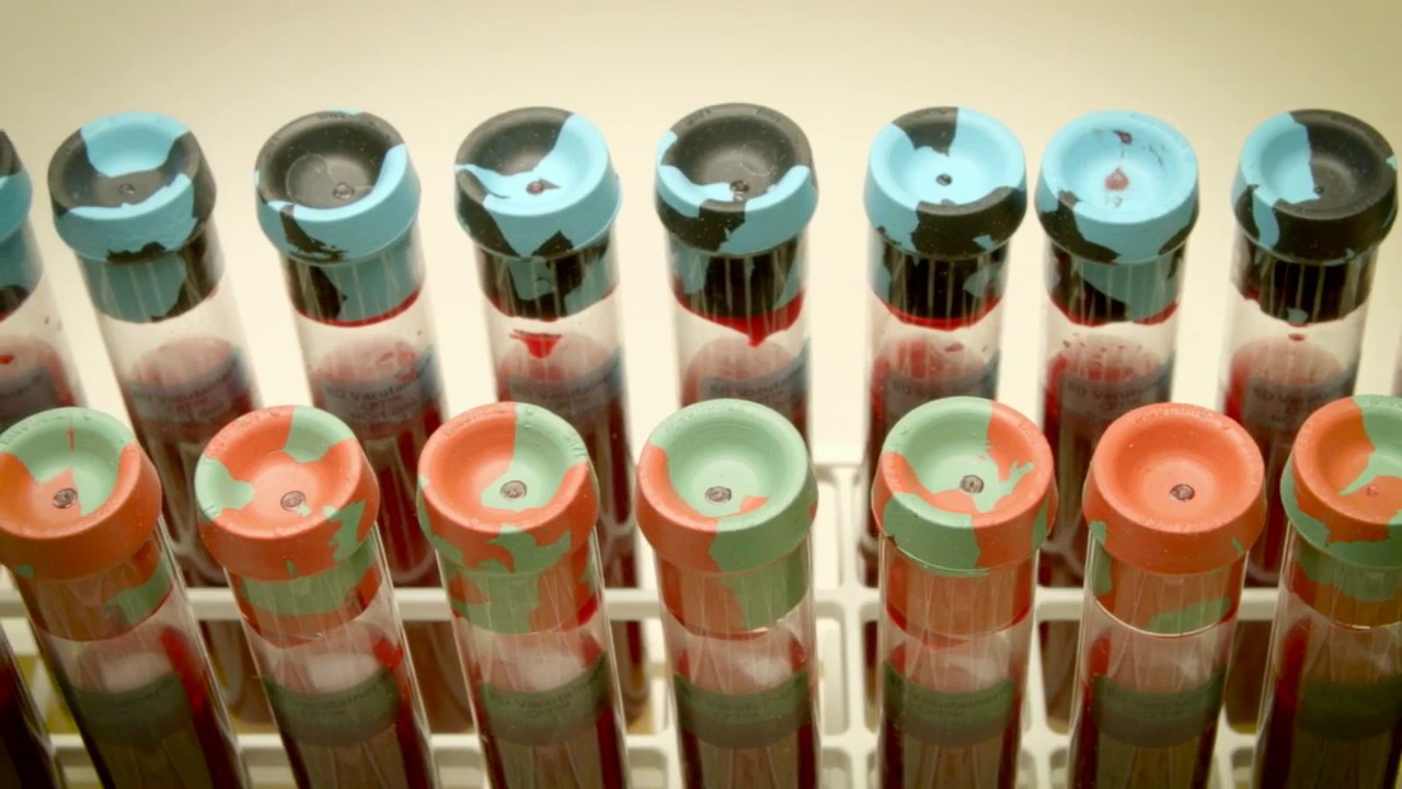 BD Vacutainer&reg; CPT&trade; Cell Preparation Tube System