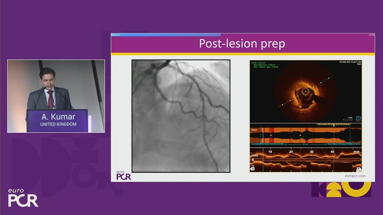 Transforming PCI: mastering the implementation of drug-eluting balloons - EuroPCR 2025