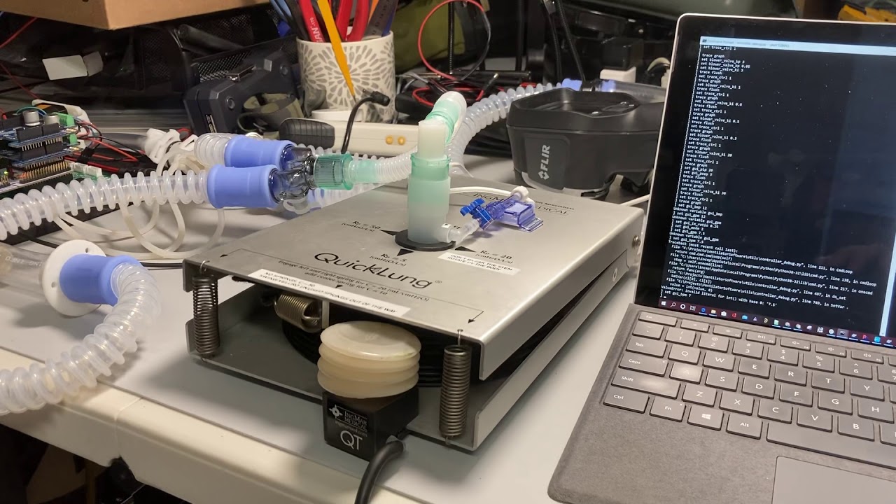 RespiraWorks Update #12: Breath Detection works the first time it&rsquo;s tested on the QuickLung