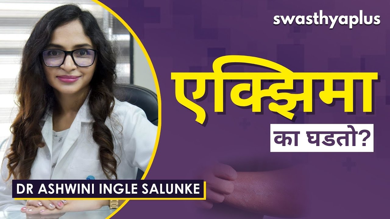 एक्झिमा म्हणजे काय? | Eczema in Marathi | Signs & Treatment | Dr Ashwini Ingle Salunke