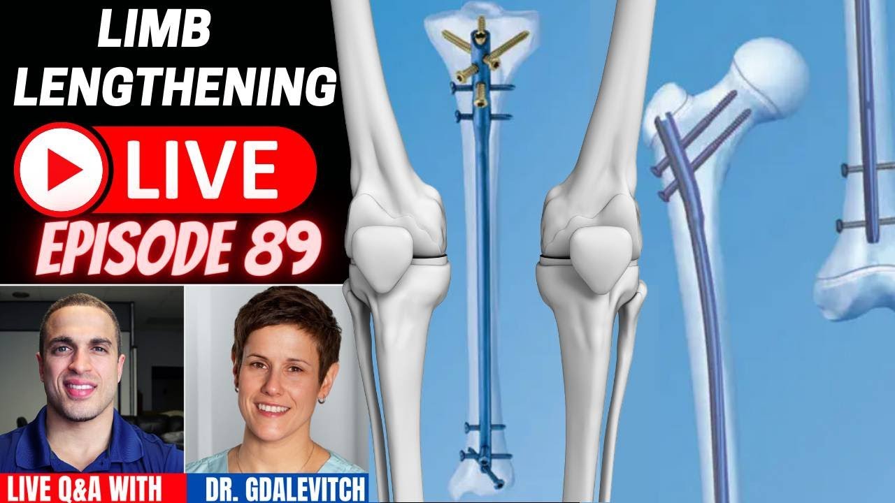 Limb Lengthening LIVE Episode 89 - Dr. Marie Gdalevitch of CLLC - Montreal Quebec Canada