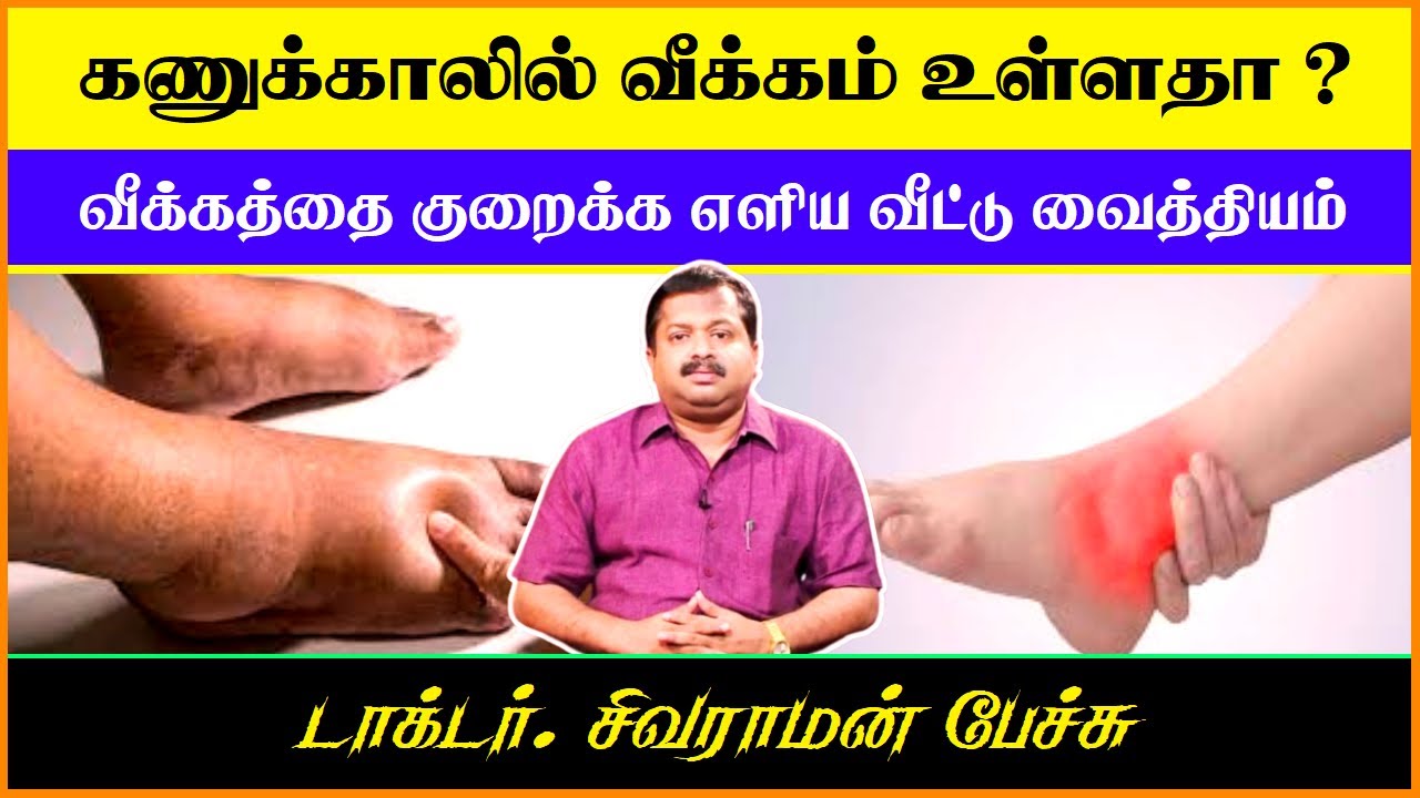 கணுக்கால் வீக்கத்தை குறைக்க சில எளிய வழிகள் ! | Dr Sivaraman Speech in Tamil | Ankles Swollen Remedy