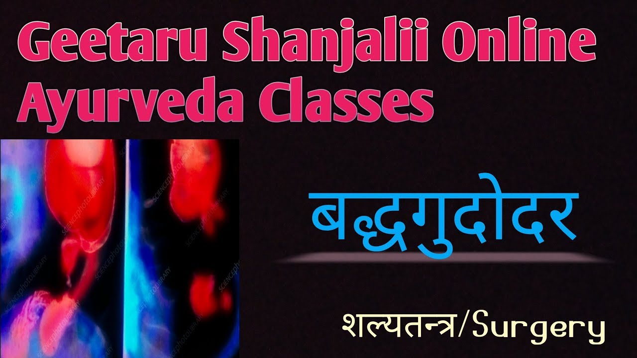 बद्धगुदोदर badhgudodar by Geetaru #Gitaru #shalytantra #surgery #bams #AYURVED #shanjalii #BAMS