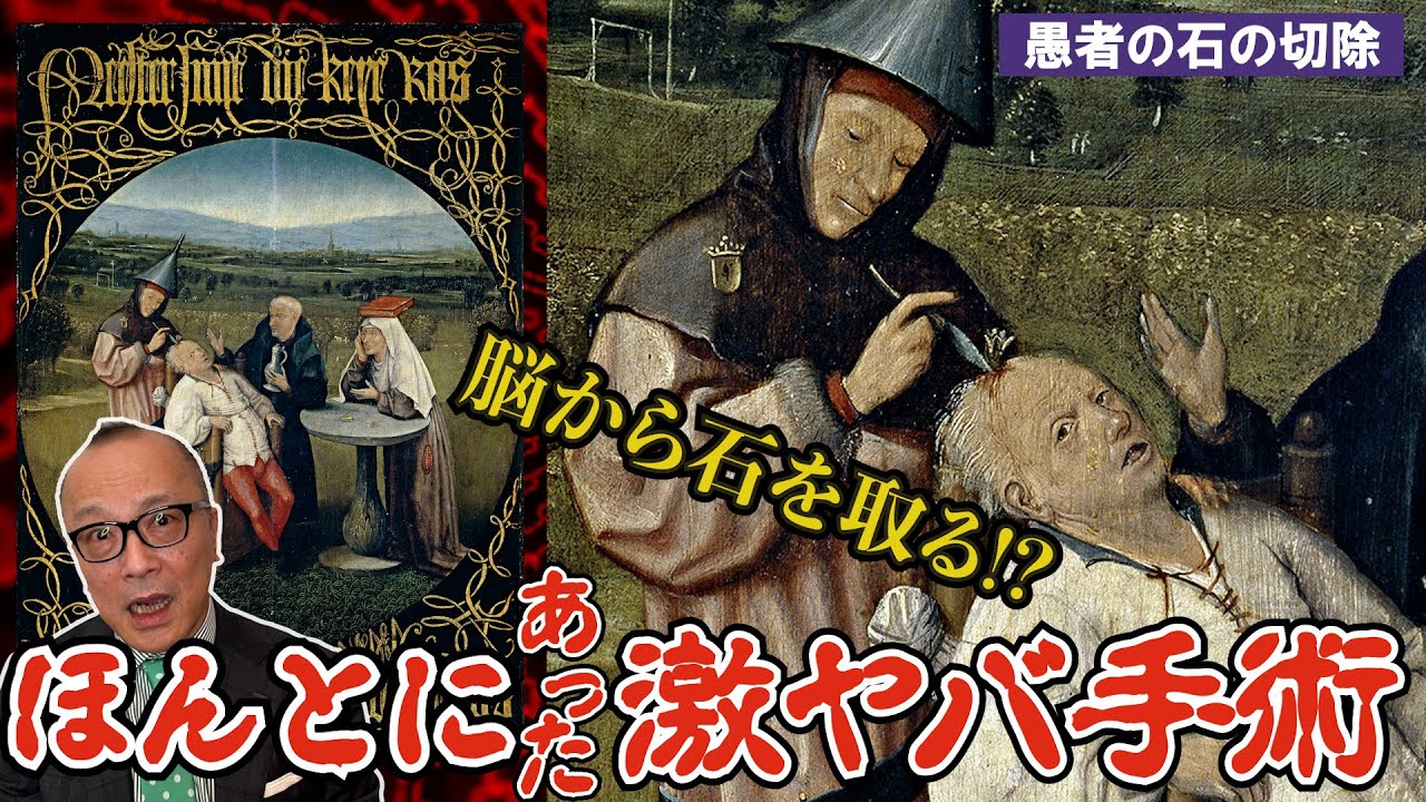 【絵で見る昔のトンデモ医療】恐怖！頭から「石」を取り出す手術とは？【インカ帝国とも関係！？ヒエロニムス・ボス「愚者の石の切除」を山田五郎が解説】