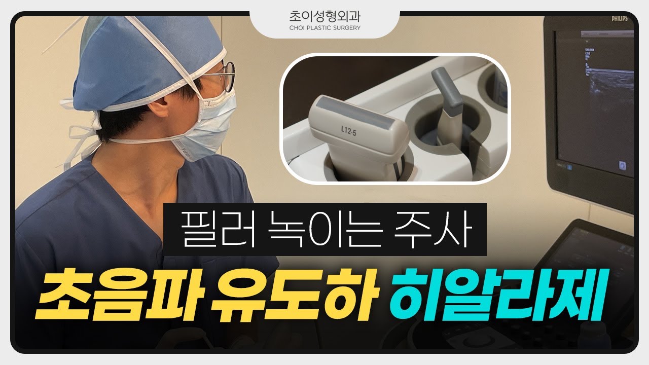 [EN/JP/CN] 필러, 이제 초음파로 보면서 녹이세요! [초이성형외과]