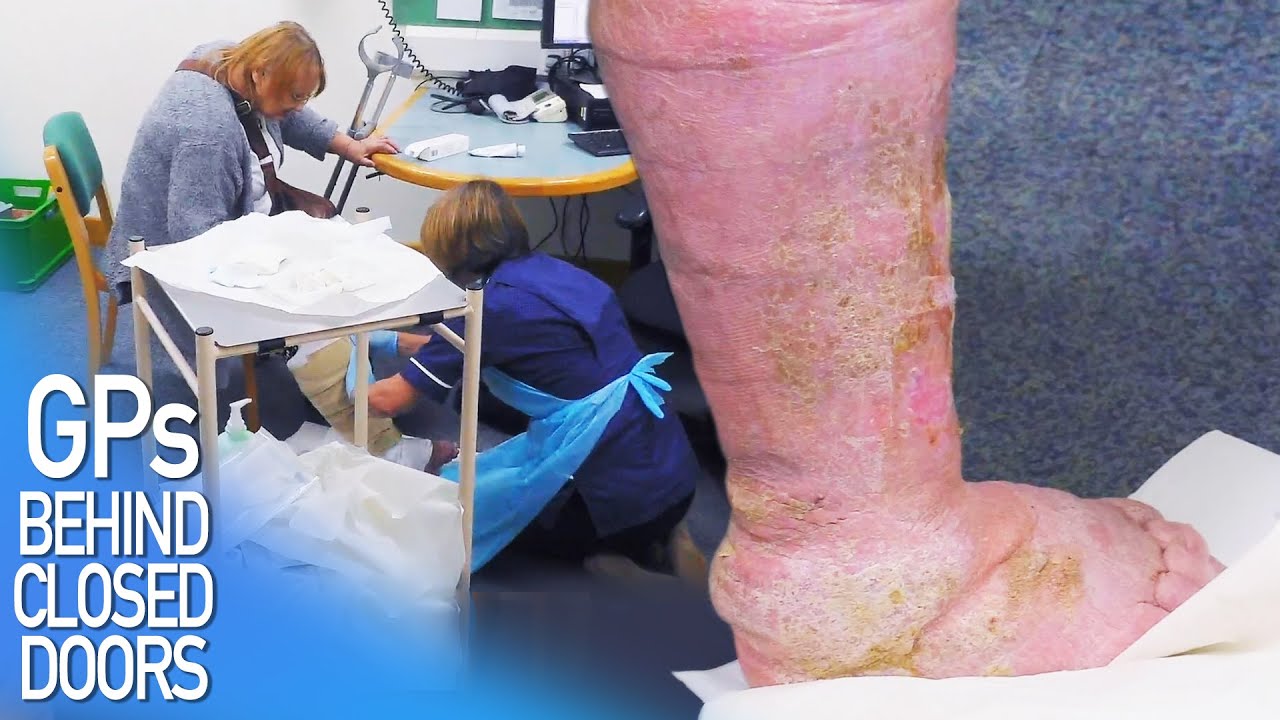 GP Carries Out A Much Needed Dressing Change | FULL EPISODE S05E26 | GPs: Behind Closed Doors