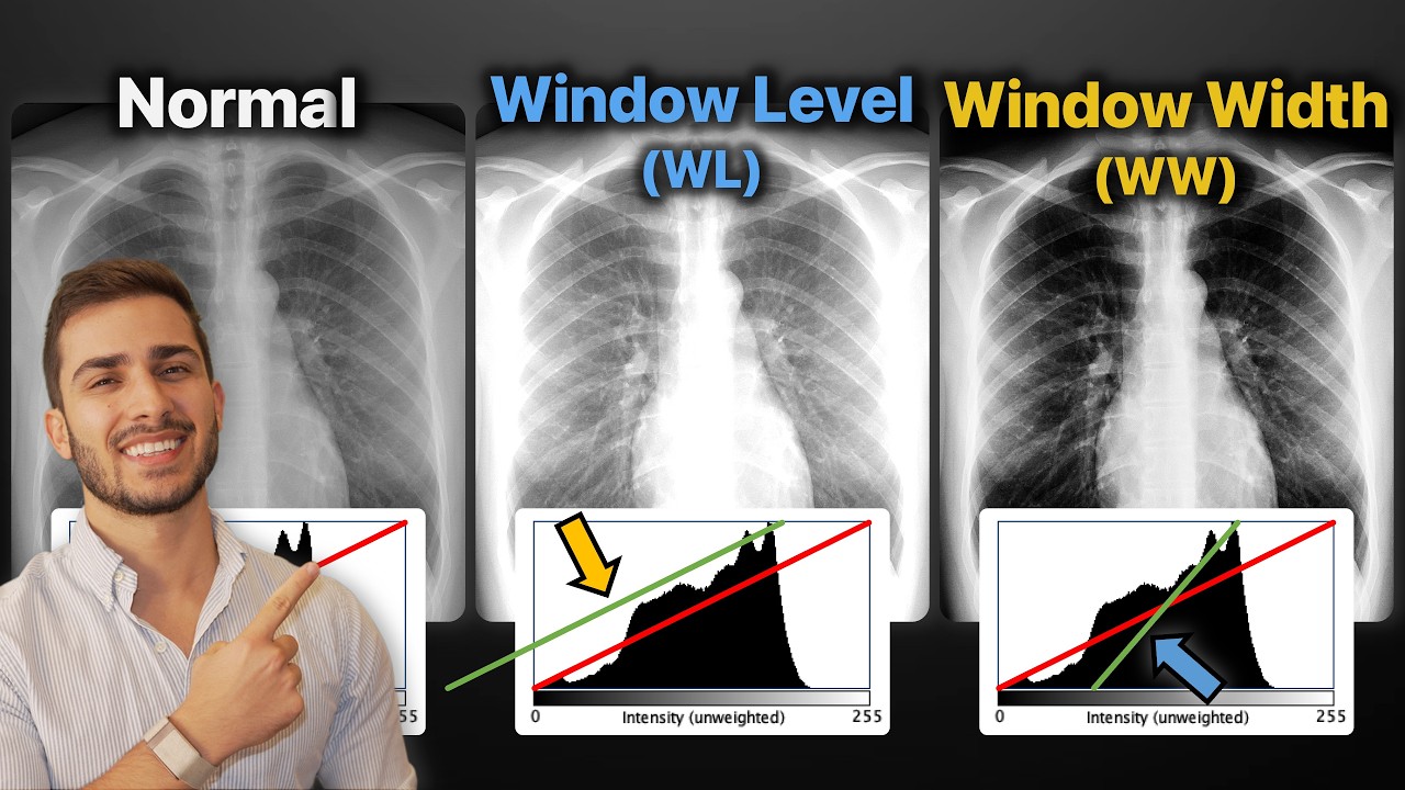 Window Width (WW) and Window Level (WL): Explained! | Everything You Need To Know