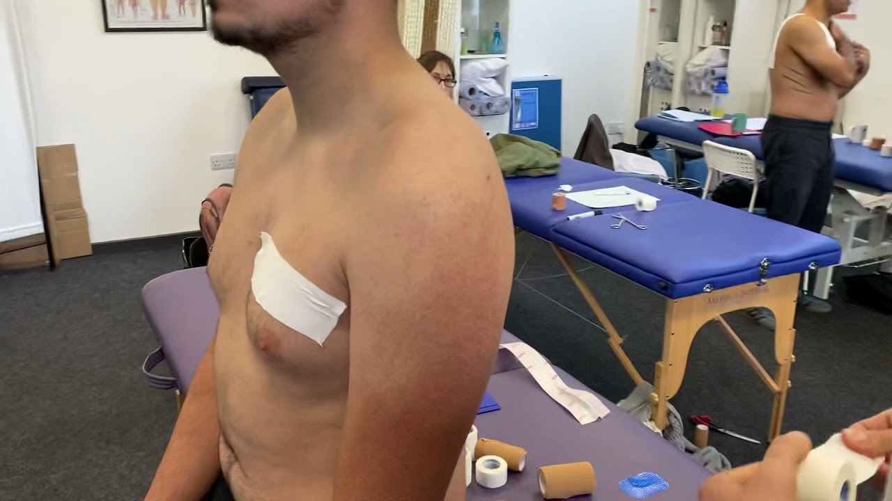 Acromio-clavicular (AC) Joint Separation taping technique