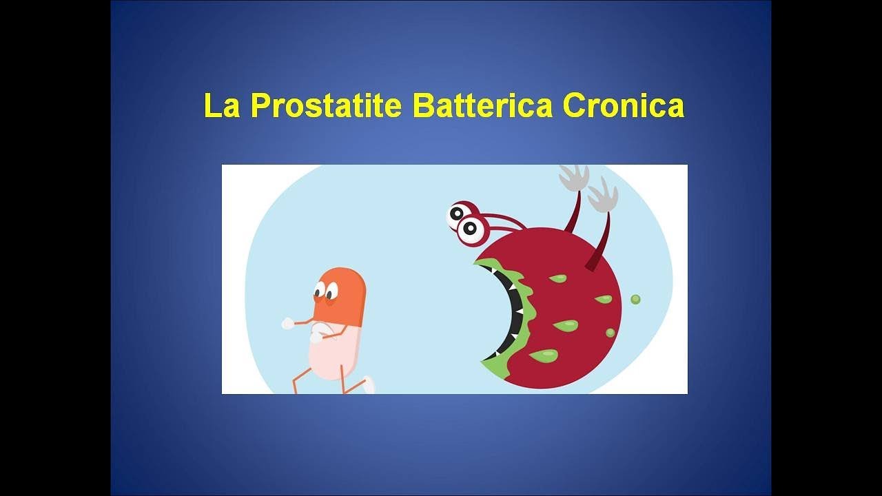 Prostatite Batterica Cronica. Urologo esperto nella cura della prostatite a Roma e Viterbo