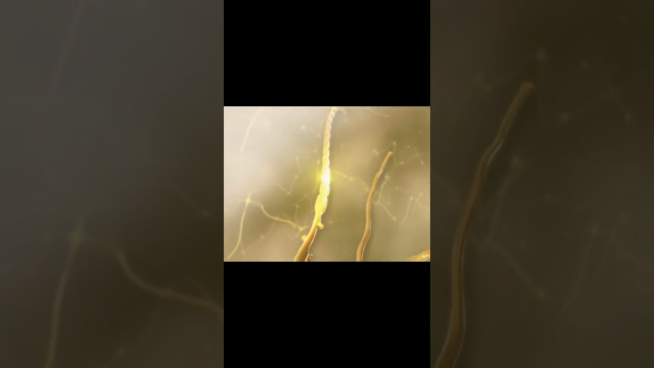 arco reflexo - seu corpo na dor 👀