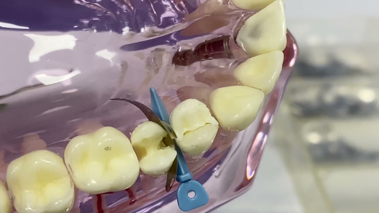 Dental V Rings, Palodent Sectional Matrix System