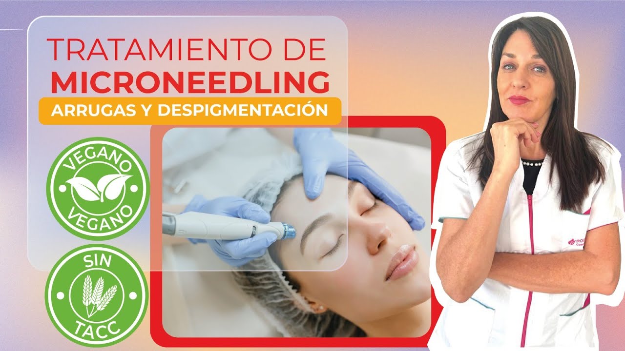Tratamiento con microneedling para arrugas y manchas en la misma sesión.