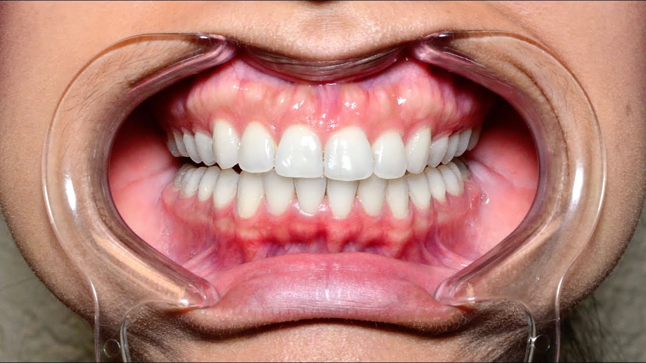 SnapCorrect Smile Selfie Guide