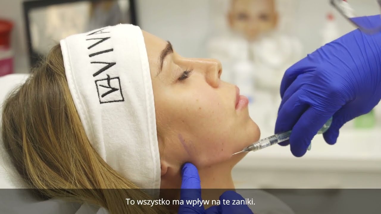 Odbudowa objętości twarzy - zabieg wolumetryczny z użyciem kwasu hialuronowego StylAge