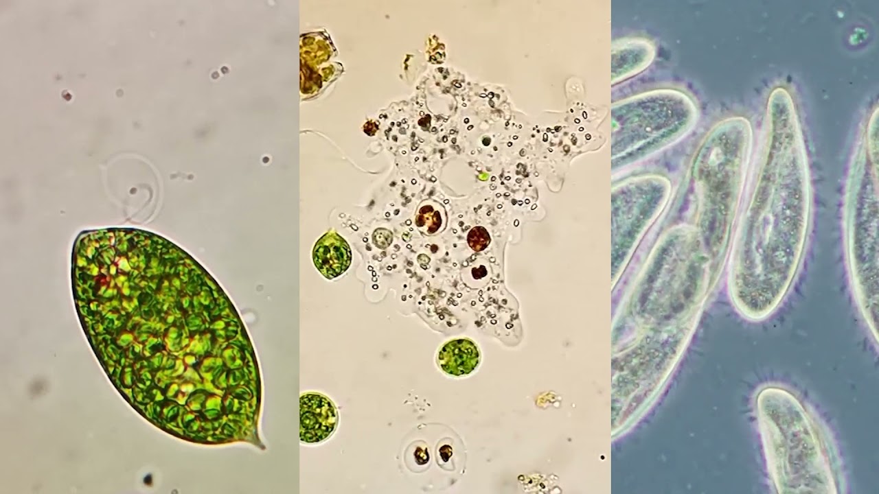 Microorganism moving methods - Flagella, Pseudopodia, and Cilia