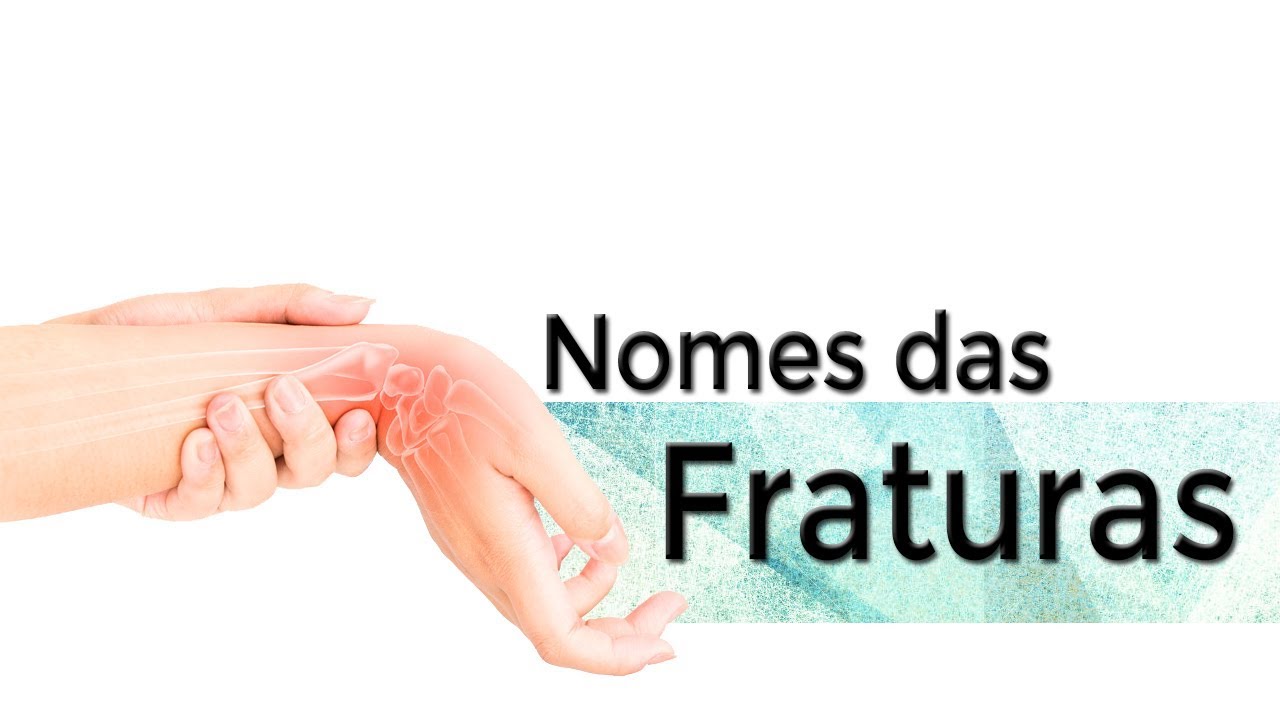 Fisioterapia Ortop&eacute;dica - Nomes das Fraturas