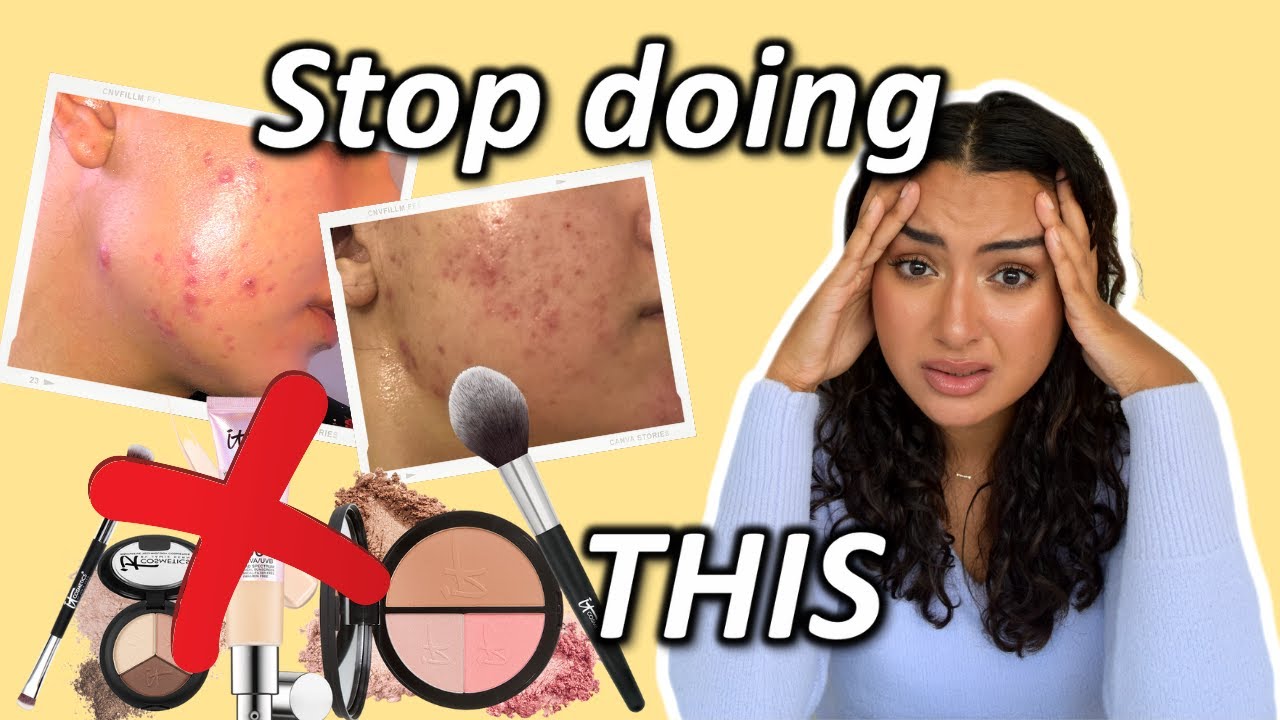 5 Mistakes to AVOID if your skin is PURGING | Tretinoin (Retin A) + Retinoids. Skin barrier damage!