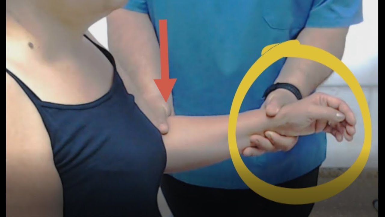 TENDINITIS DEL MÚSCULO INFRAESPINOSO
