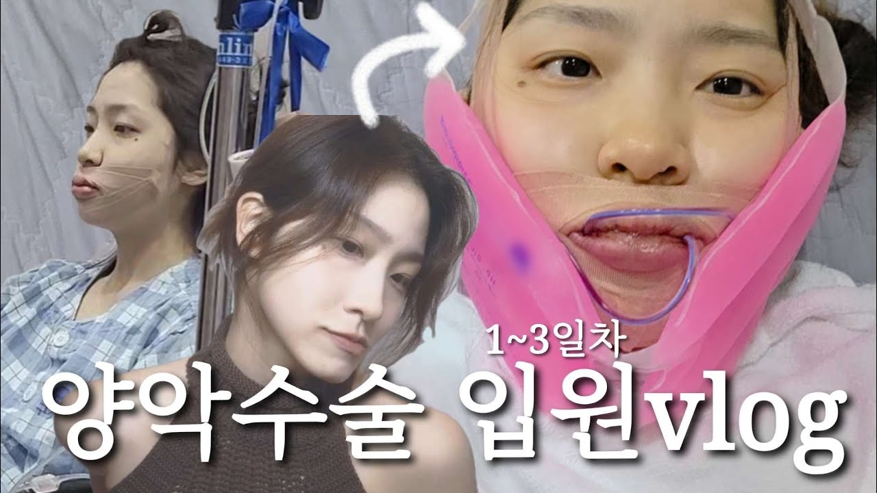 [ENG] 양악수술 입원1~3일차브이로그 (with.가루약 꿀팁)