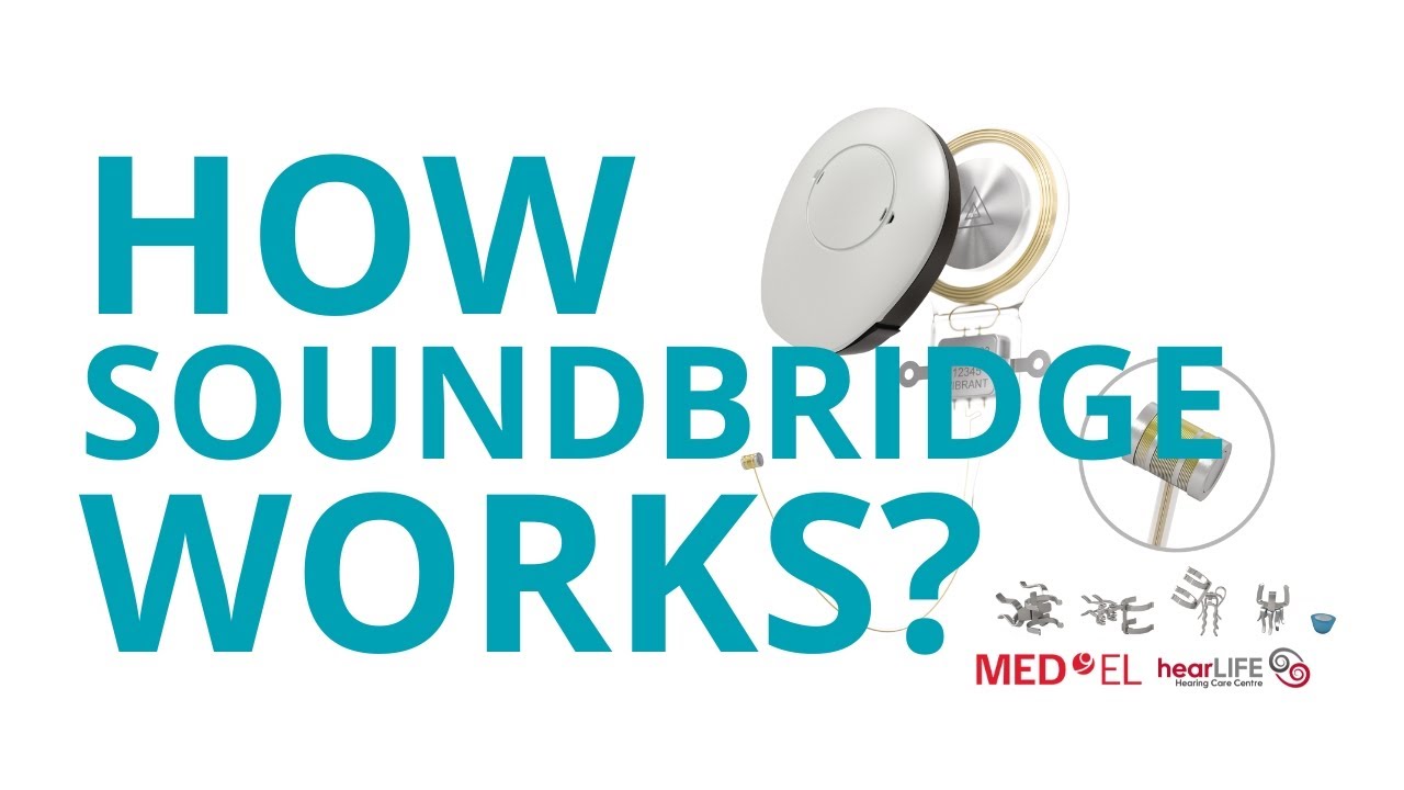 How the VORP 503 Works with SAMBA 2 | Vibrant Soundbridge System by MED-EL | HearLIFE Singapore