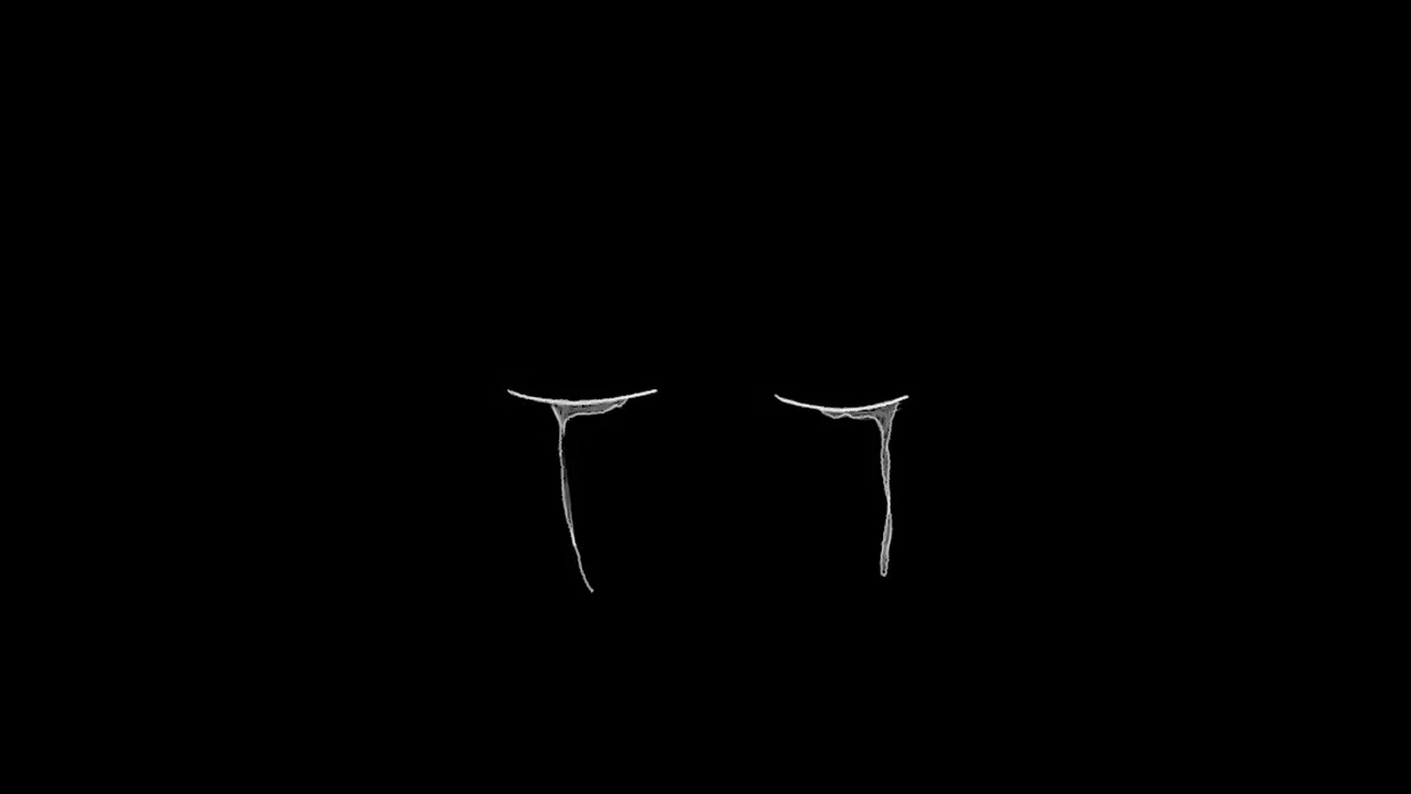 Blame by Tim Gunter ( Remix Slowed )