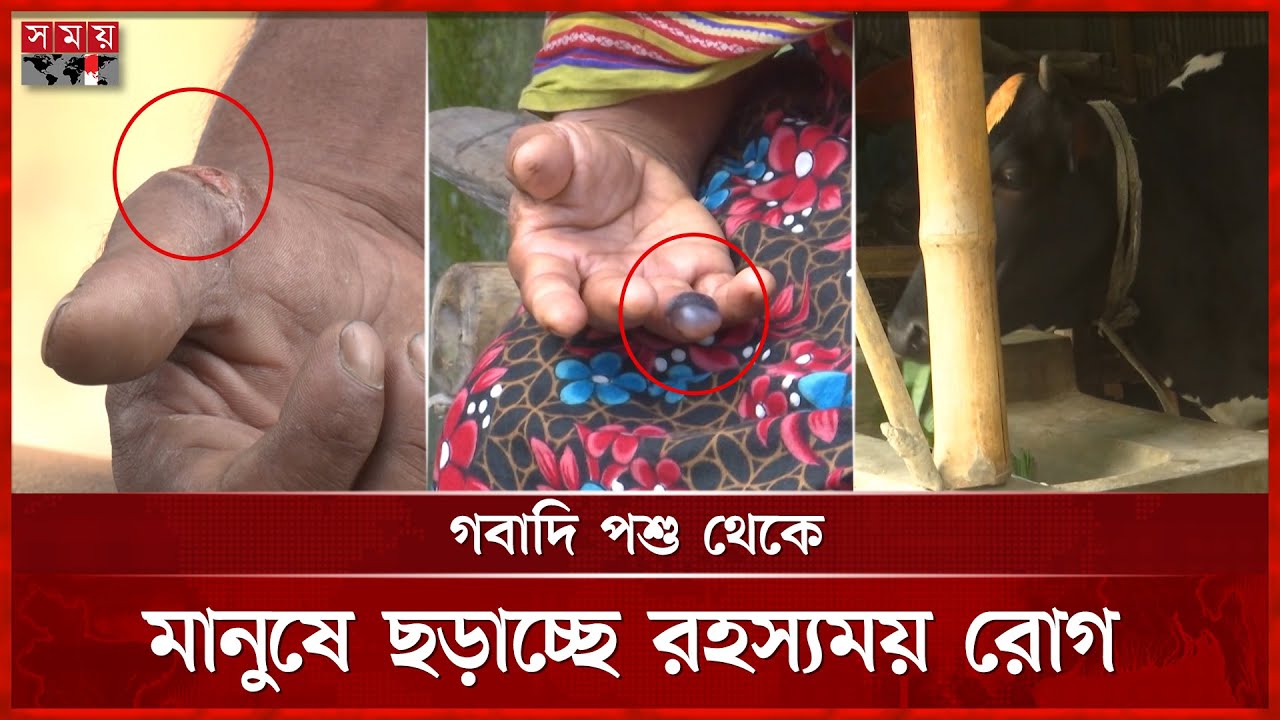 অজানা রোগের প্রকোপ: সময় সংবাদে প্রচারের পর তোড়জোড় শুরু | Unknown Disease | Pirgacha News | Rangpur