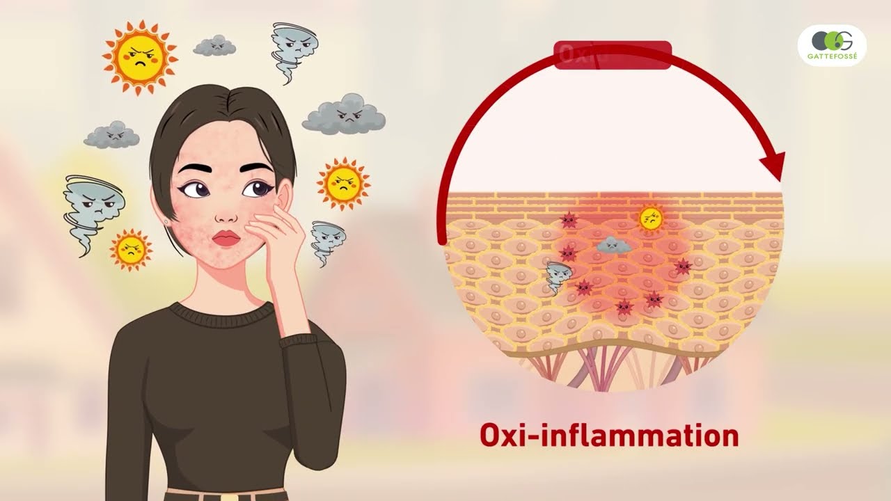 Noxifense™, the NEW 360° approach to skin sensitivity | Gattefossé