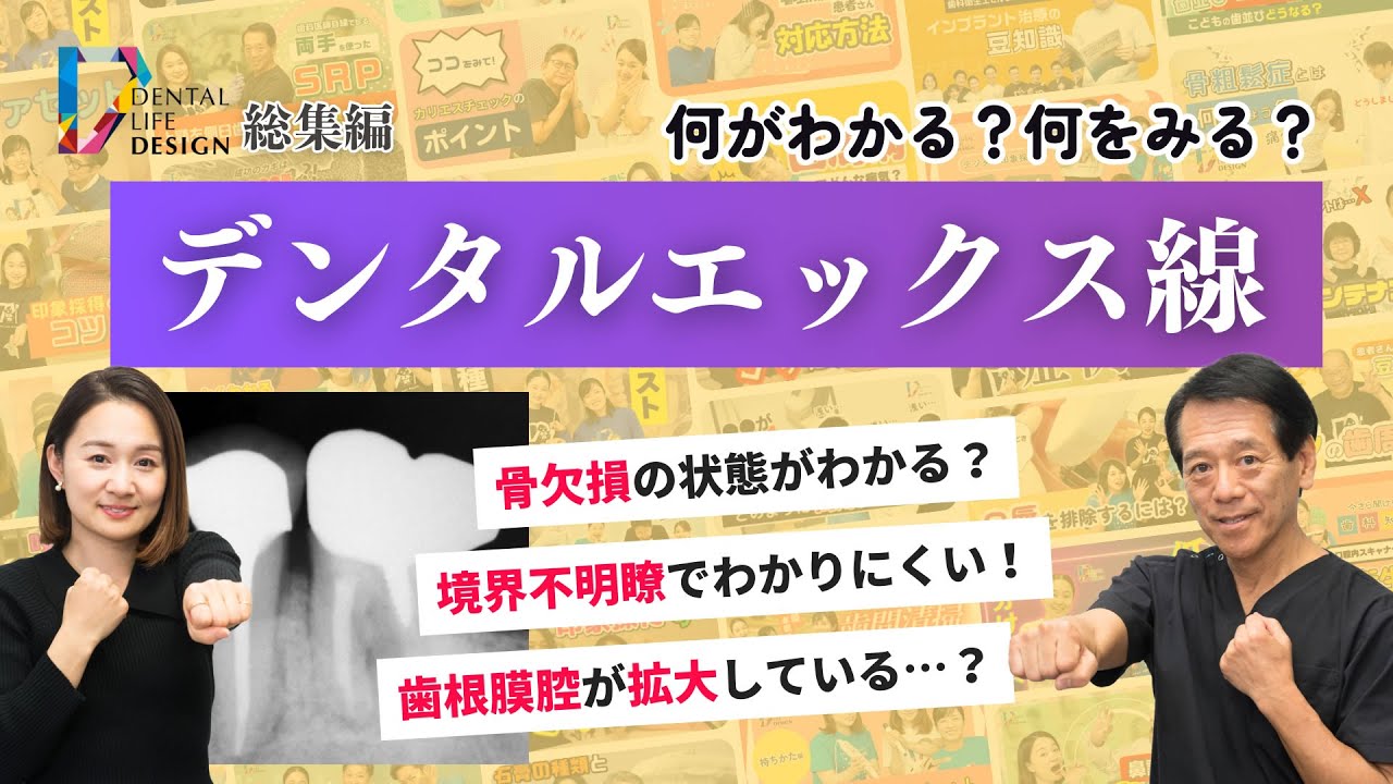【X線撮影 シリーズ総集編】歯科衛生士さんのための予防歯科　若林歯科医院編【教えて！若林健史先生】