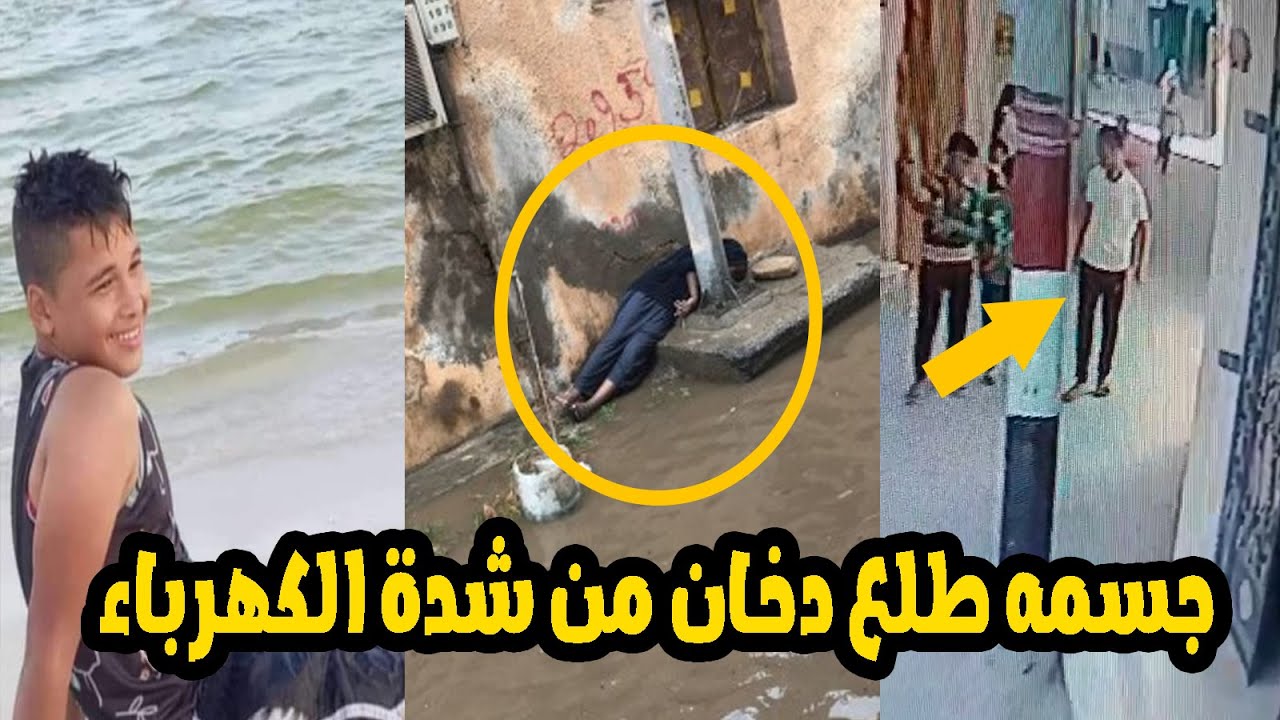 “جسمه طلع دخان من شدة الكهرباء