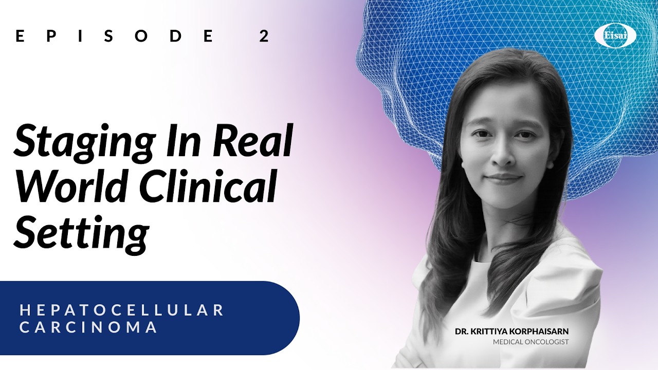 Staging in the Real World Clinical Setting in HCC - For HCPs