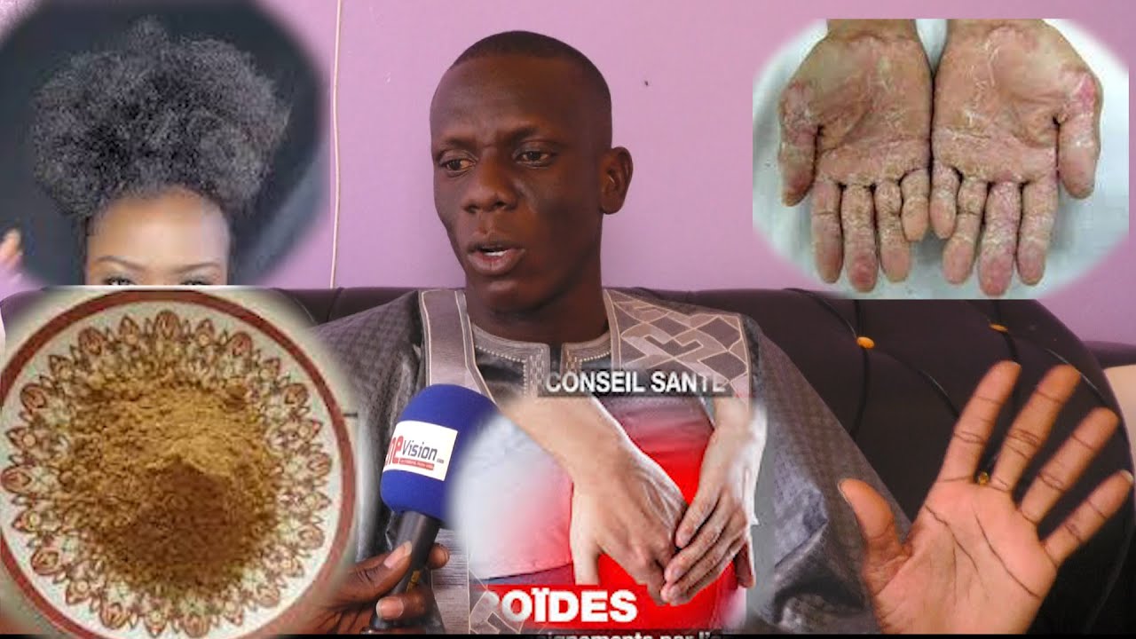Ndiarignou Soungouf Fayar, Ndoxou Siti ak Hémorroide, djiguene gu amul karaw Par Moustapha Ndiaye