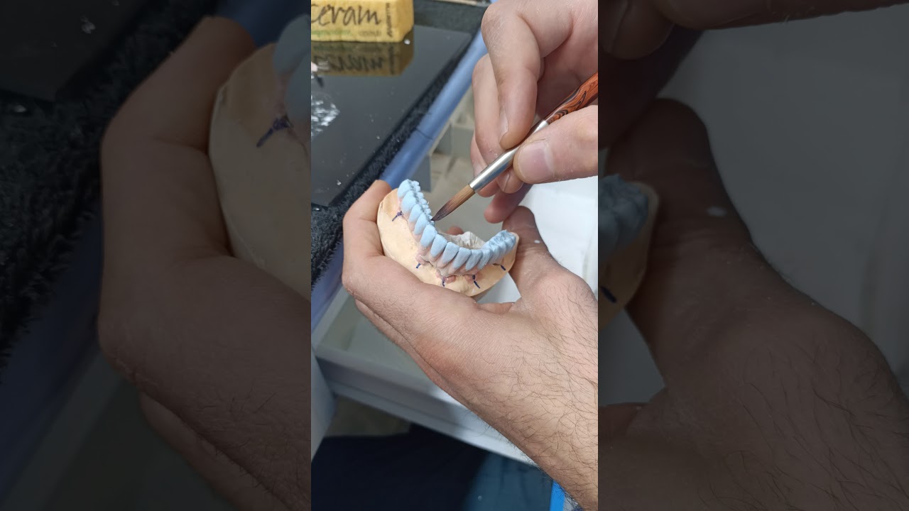 porselen tepimi final kontrol